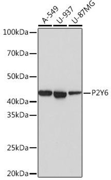 Cell Biology Antibodies 17 Anti-P2Y6 Antibody CAB3708