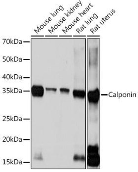 Cell Biology Antibodies 17 Anti-Calponin Antibody CAB3734