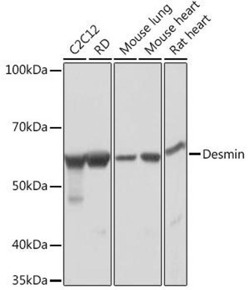 Cell Biology Antibodies 17 Anti-Desmin Antibody CAB3736