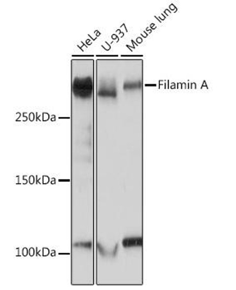 Cell Biology Antibodies 17 Anti-Filamin A Antibody CAB3738
