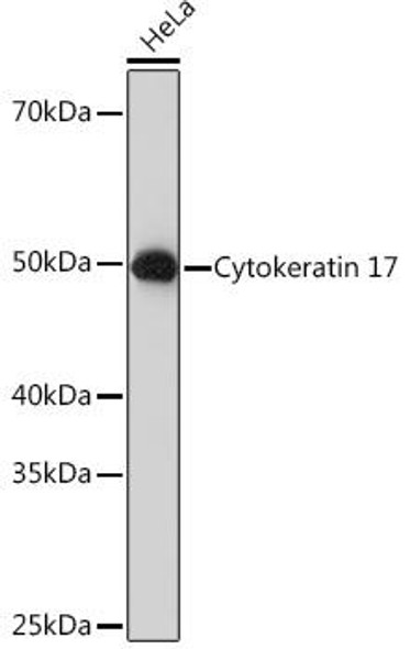 Cell Biology Antibodies 17 Anti-Cytokeratin 17 Antibody CAB3769