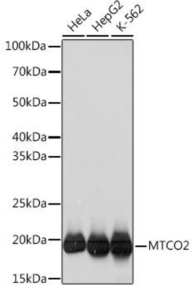 Cell Biology Antibodies 17 Anti-MTCO2 Antibody CAB3843