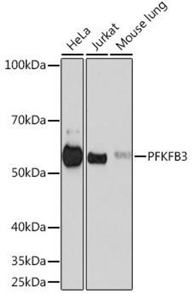 Cell Biology Antibodies 17 Anti-PFKFB3 Antibody CAB3934