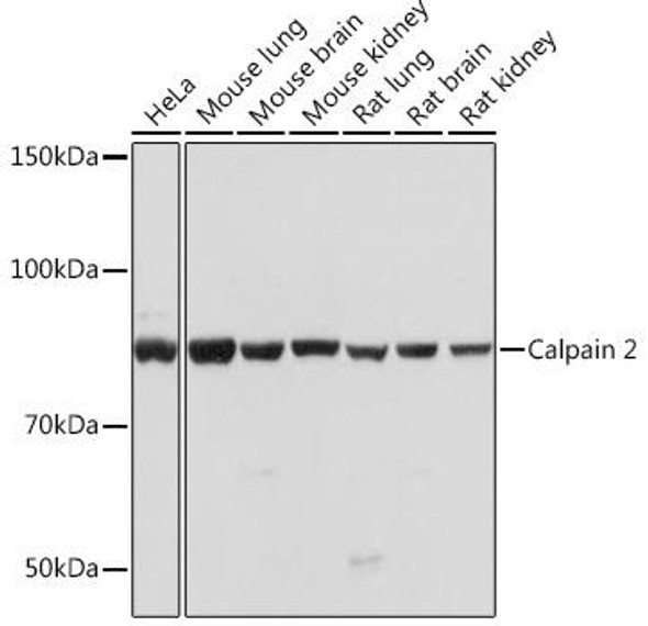 Cell Biology Antibodies 17 Anti-Calpain 2 Antibody CAB4066