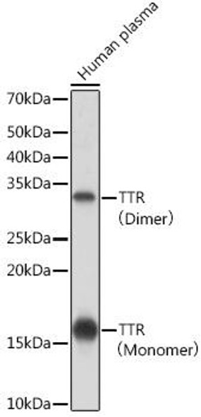 Signal Transduction Antibodies 3 Anti-TTR Antibody CAB4067