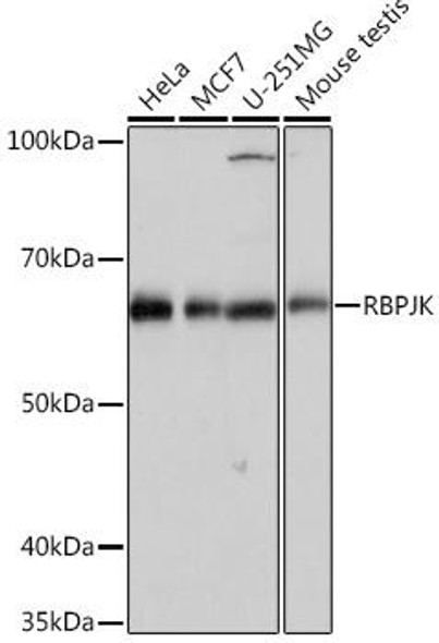 Signal Transduction Antibodies 3 Anti-RBPJK Antibody CAB4081