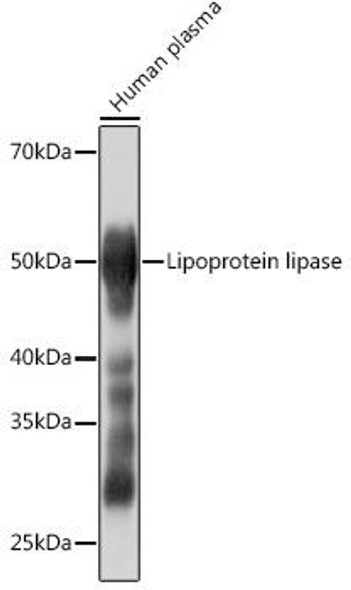 Metabolism Antibodies 3 Anti-Lipoprotein lipase Antibody CAB4115