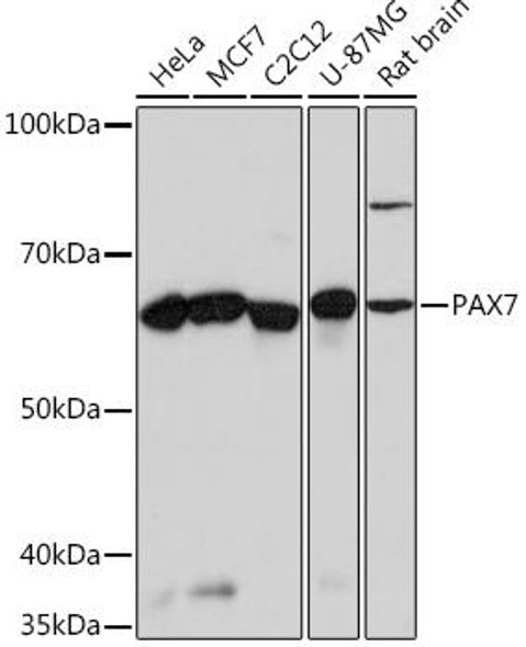 Cardiovascular Antibodies Anti-PAX7 Antibody CAB4134