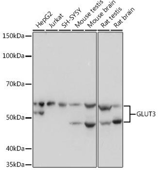 Signal Transduction Antibodies 3 Anti-GLUT3 Antibody CAB4137