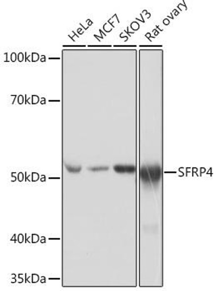 Developmental Biology Anti-SFRP4 Antibody CAB4189