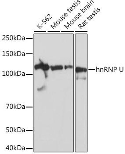 Cell Biology Antibodies 17 Anti-hnRNP U Antibody CAB4257