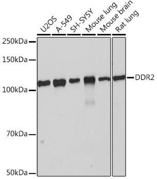 Cell Biology Antibodies 17 Anti-DDR2 Antibody CAB4296
