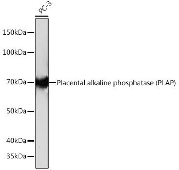 Cell Biology Antibodies 17 Anti-Placental alkaline phosphatase PLAP Antibody CAB4304