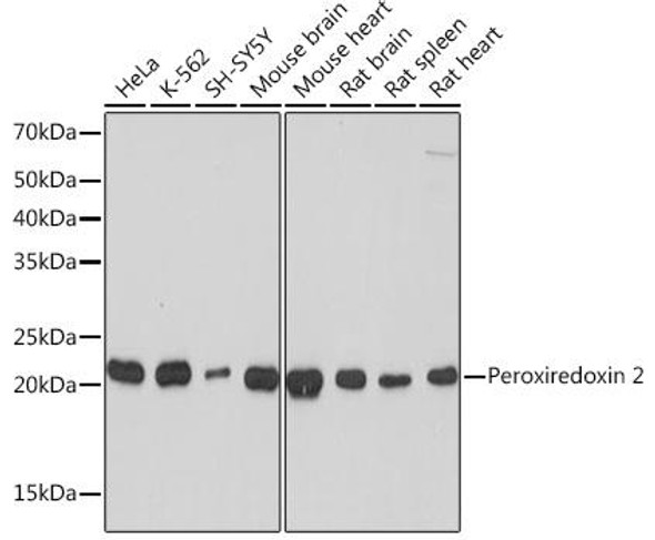 Cell Biology Antibodies 17 Anti-Peroxiredoxin 2 Antibody CAB4308