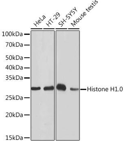 Cell Biology Antibodies 17 Anti-Histone H1.0 Antibody CAB4342