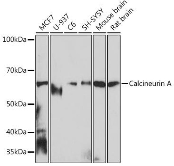Cell Biology Antibodies 17 Anti-Calcineurin A Antibody CAB4346