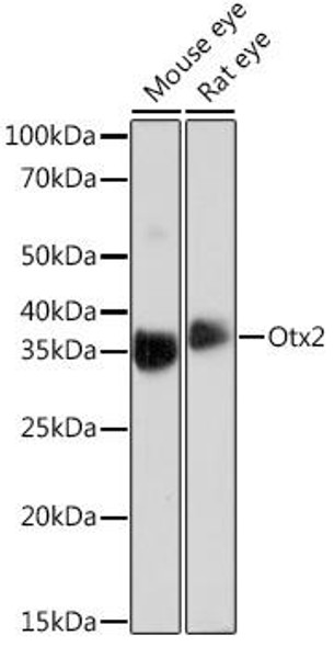 Cell Biology Antibodies 17 Anti-Otx2 Antibody CAB4351