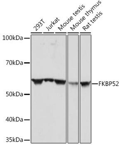 Cell Biology Antibodies 17 Anti-FKBP52 Antibody CAB4356