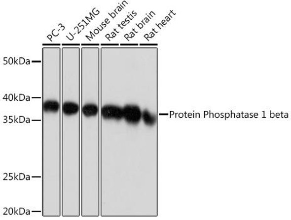 Cell Biology Antibodies 17 Anti-Protein Phosphatase 1 beta Antibody CAB4364