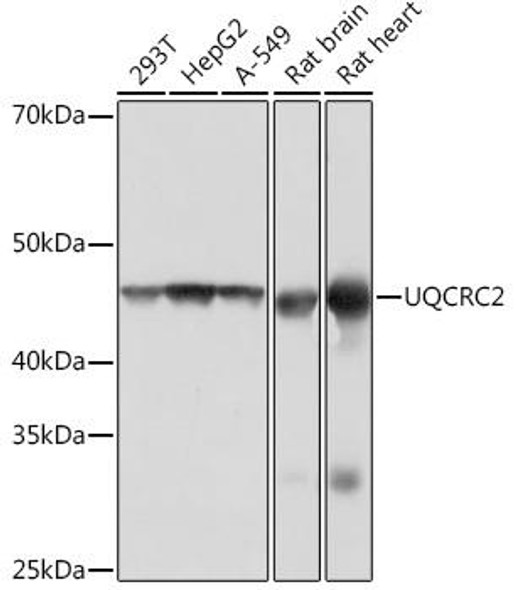 Cell Biology Antibodies 17 Anti-UQCRC2 Antibody CAB4366