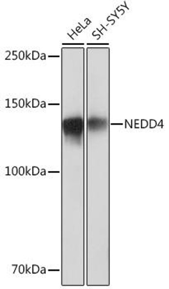 Immunology Antibodies 3 Anti-NEDD4 Antibody CAB4385