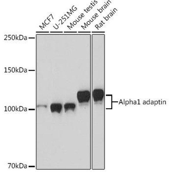 Cell Biology Antibodies 17 Anti-Alpha1 adaptin Antibody CAB4403