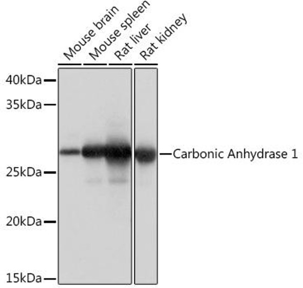 Cell Biology Antibodies 17 Anti-Carbonic Anhydrase 1 Antibody CAB4406