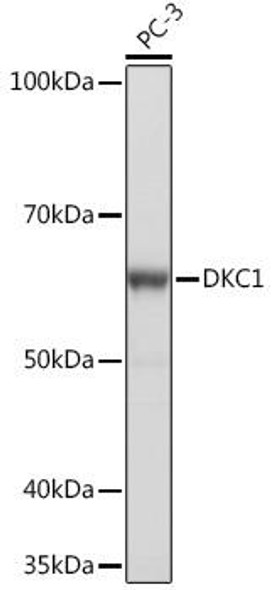 Cell Biology Antibodies 17 Anti-DKC1 Antibody CAB4407
