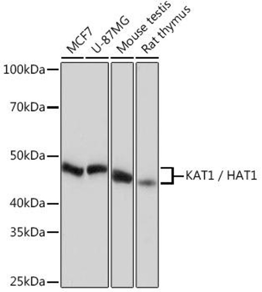 Cell Biology Antibodies 17 Anti-KAT1 / HAT1 Antibody CAB4423