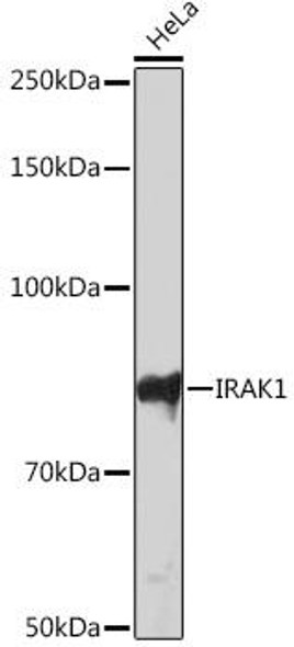 Immunology Antibodies 3 Anti-IRAK1 Antibody CAB4439