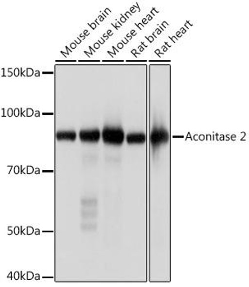 Metabolism Antibodies 3 Anti-Aconitase 2 Antibody CAB4524