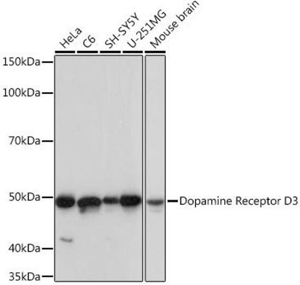 Cell Biology Antibodies 17 Anti-Dopamine Receptor D3 Antibody CAB4587