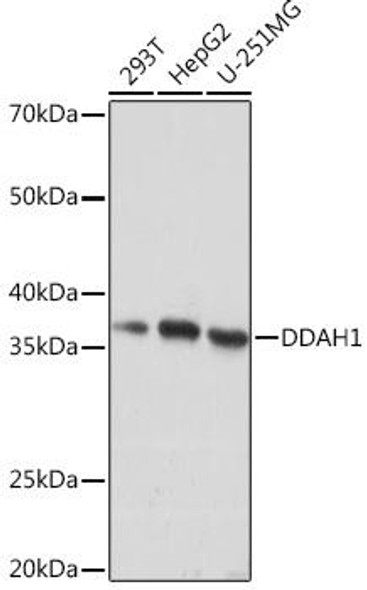 Cell Biology Antibodies 17 Anti-DDAH1 Antibody CAB4591