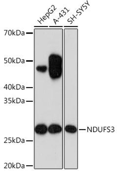 Cell Biology Antibodies 17 Anti-NDUFS3 Antibody CAB4602