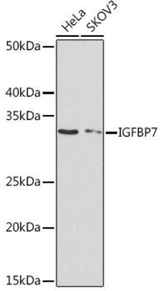 Cell Biology Antibodies 17 Anti-IGFBP7 Antibody CAB4615