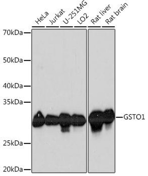 Cell Biology Antibodies 17 Anti-GSTO1 Antibody CAB4636