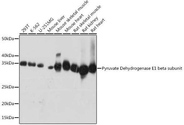 Metabolism Antibodies 3 Anti-PDHB Antibody CAB4645