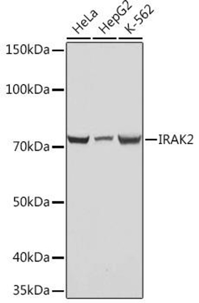Cell Biology Antibodies 17 Anti-IRAK2 Antibody CAB4655