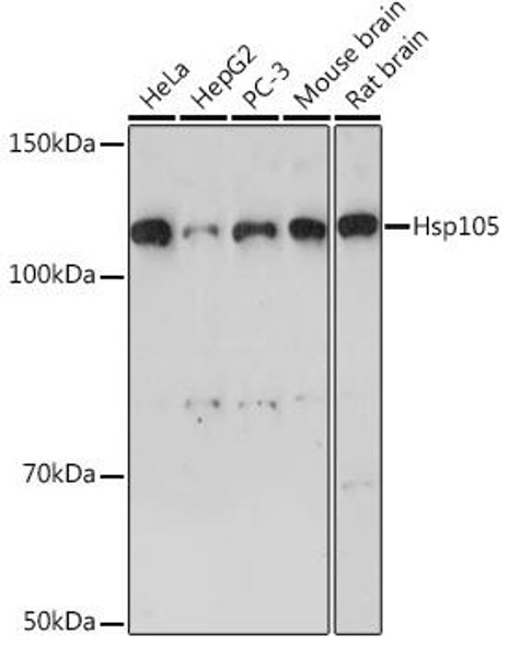 Metabolism Antibodies 3 Anti-Hsp105 Antibody CAB4687