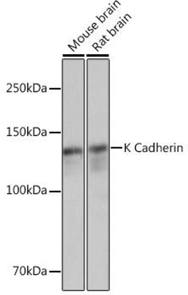 Cell Biology Antibodies 17 Anti-K Cadherin Antibody CAB4689