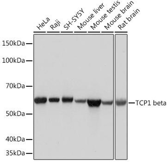 Cell Biology Antibodies 17 Anti-TCP1 beta Antibody CAB4700