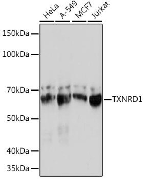 Cell Biology Antibodies 17 Anti-TXNRD1 Antibody CAB4725