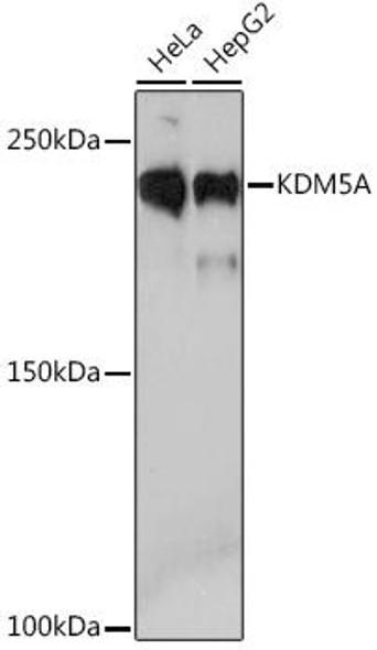 Cell Biology Antibodies 17 Anti-KDM5A Antibody CAB4755