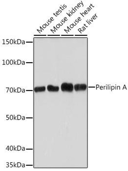 Metabolism Antibodies 3 Anti-Perilipin A Antibody CAB4758