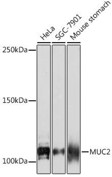 Cell Biology Antibodies 17 Anti-MUC2 Antibody CAB4767