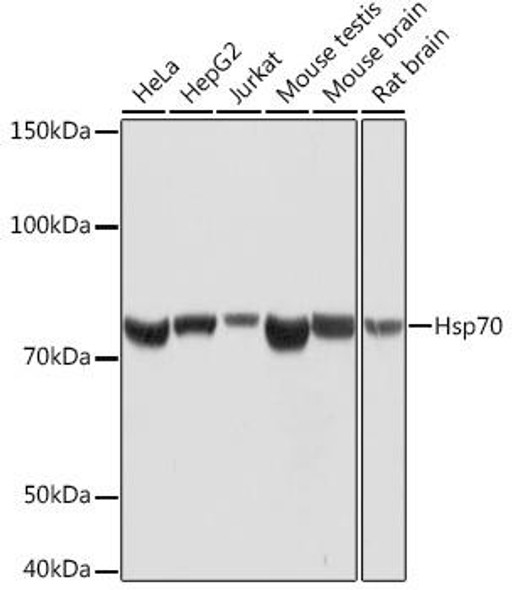 Cell Biology Antibodies 15 Anti-Hsp70 Antibody CAB4777