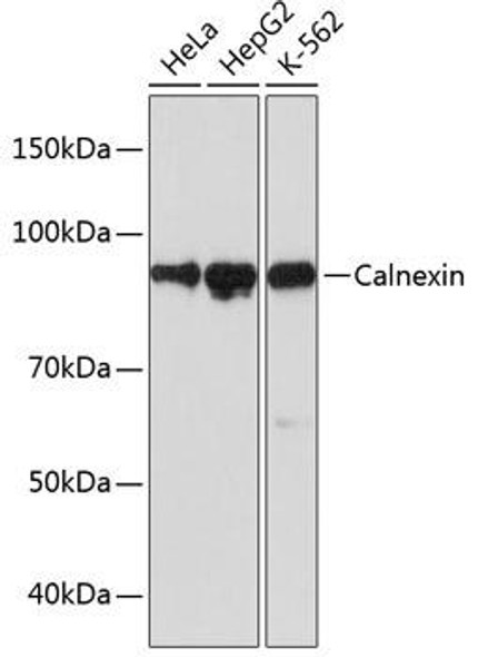 Immunology Antibodies 3 Anti-Calnexin Antibody CAB4846