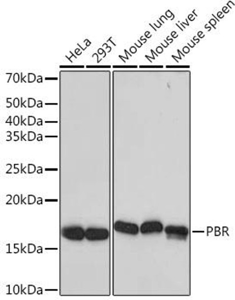 Cell Biology Antibodies 17 Anti-PBR Antibody CAB4881