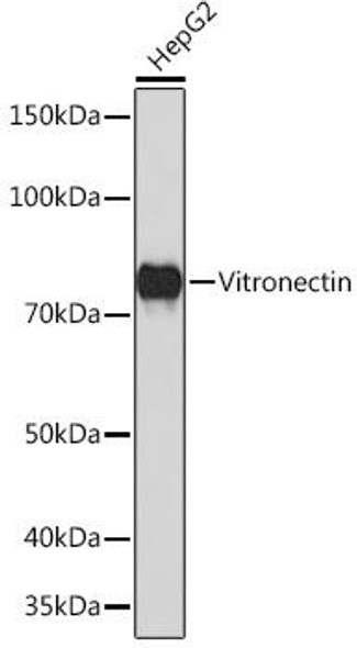 Cell Biology Antibodies 17 Anti-Vitronectin Antibody CAB4883