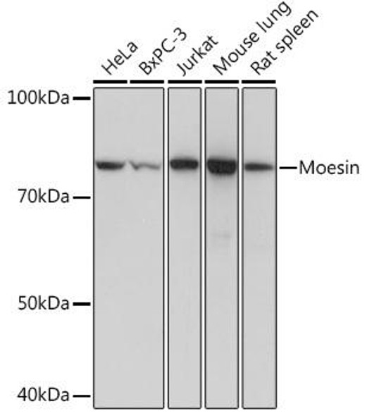 Immunology Antibodies 3 Anti-Moesin Antibody CAB4915